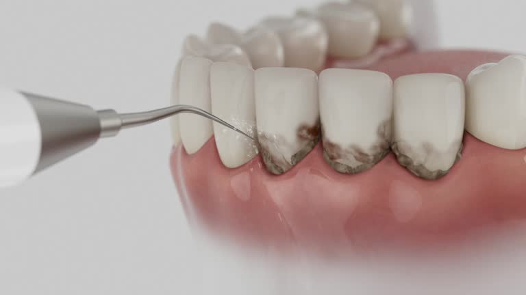 Trusted Tooth Extraction service in Bonanza, GA - Dentist Open Now